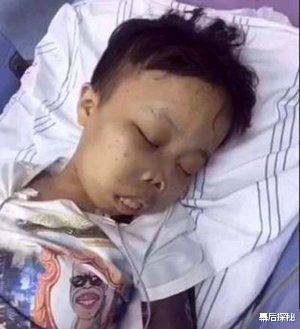刘梓晨|奇葩长相走天下：前有整容狂魔刘梓晨，后有嘟嘟姐刻意丑化自己