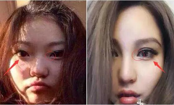 『整容』罗志祥内涵周扬青“整容”！深扒她究竟整了哪些地方……