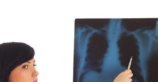 医生|女性体检时大都不想做胸透，医生究竟能看到啥？男医生：有些尴尬