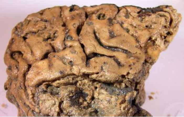 科学家▲科学家发现了一颗“活着的大脑”，保存了2600年，简直不可思议