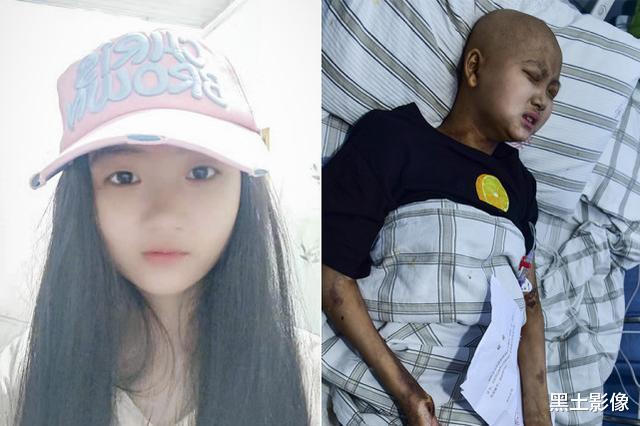 医生|花季少女住进医院后俏容颜变“黑大叔”，偷听医生谈话后留下遗言