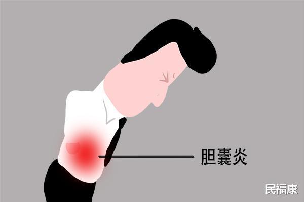 #胆囊#切除胆囊的人，寿命会减短吗？哪些地方受影响大？