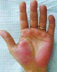 肝脏|肝病\救星\找到了,不是猪血,没事泡点,清理肝毒,肝越来越好