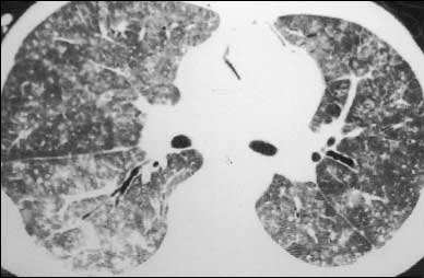 「狂犬病」新冠病毒是否会导致世界末日？人类还能撑到到明年后年吗？