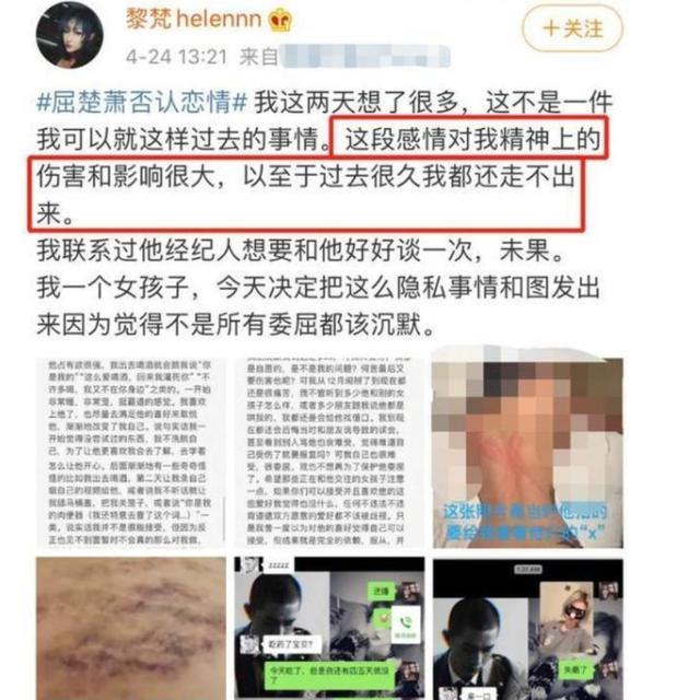 吴京|被吴京捧红的白眼狼，爆红后却“反咬”吴京，现落魄为过街老鼠