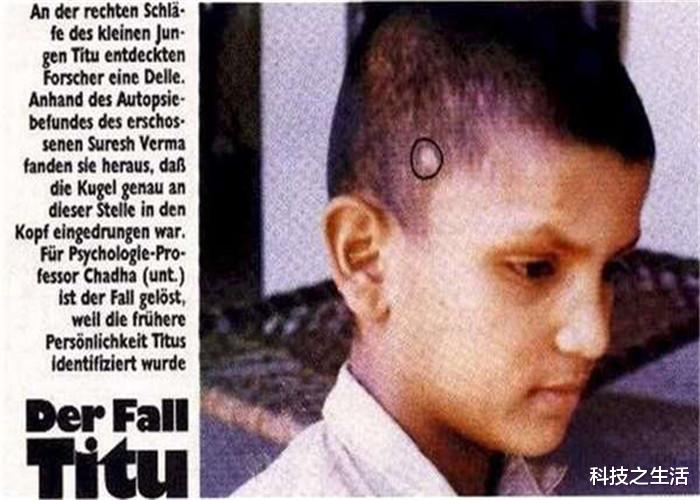 ##人类真的有轮回吗？据说我们身上的胎记，可能就是最好的证明！