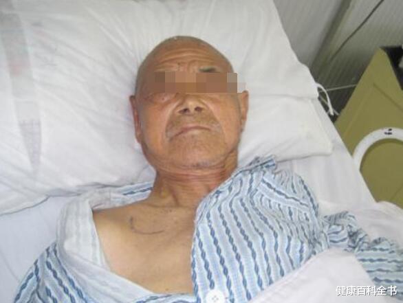 『尿毒症』65岁老汉娶45岁女保姆为妻，半年后住进医院，医生：不知道控制