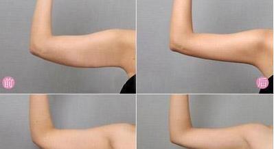 赵丽颖|赵丽颖说白了:健身有什么好处吗?为了保持身材和减肥