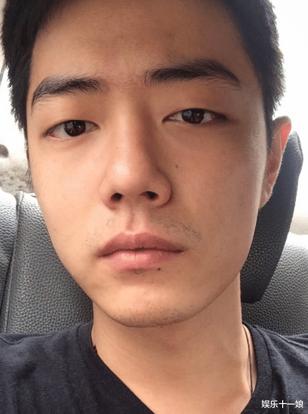 肖战被曝整容!院长怒晒签名照?自称:给明星手术的福利!