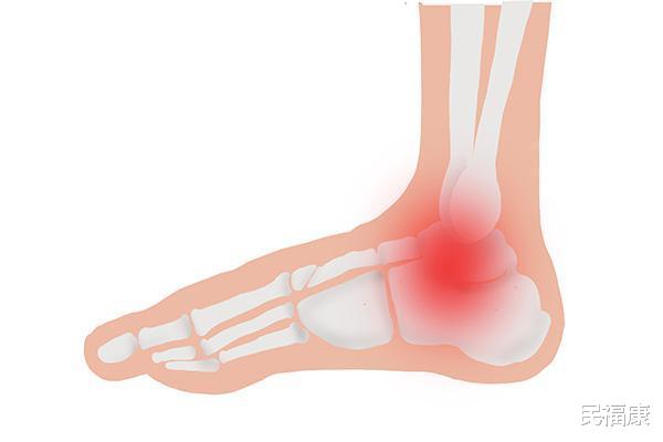 痛风▲痛风是被吃出来的!高嘌呤食物一口不吃,尿酸稳稳降