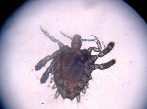 #医生#女子眼睛瘙痒无比,医生竟从睫毛里抓出20只阴虱!哪儿来的?