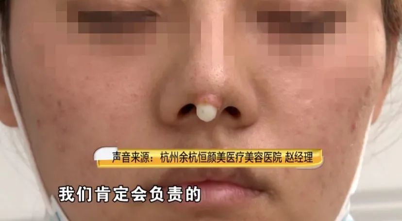 杭州|漂亮姑娘刚怀孕,鼻尖出现神秘白色物体!婆婆追问下,她瞒不住了…
