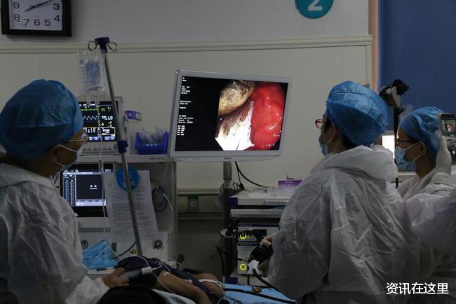 可乐|医生让患者每天4斤可乐连喝一周：消融胃结石便于取出 医生让患者每天4斤可乐连喝一周