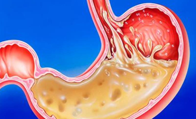 ▲胃会被越撑越大,越饿越小吗?医生说出了大实话,很多人不知道