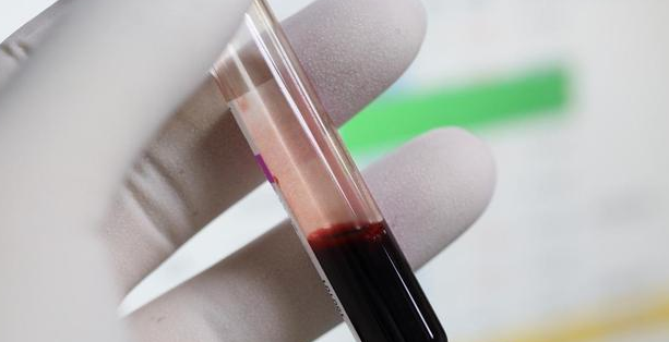 糖尿病|60后夫妻，吃素两年，双双糖尿病离世，医生：只因一种东西吃太多