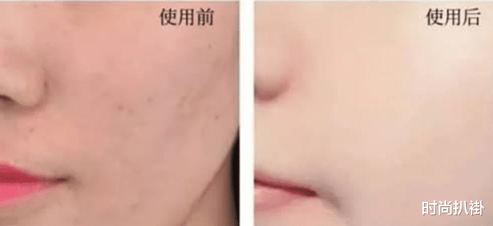 洗面奶 这些被忽略的细节，就是你颜值\上不去\的原因，怪不得皮肤一直不好