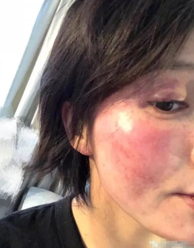 黄景瑜▲黄景瑜前妻自杀？其助理发文证实，并称无数网友发私信让她去死