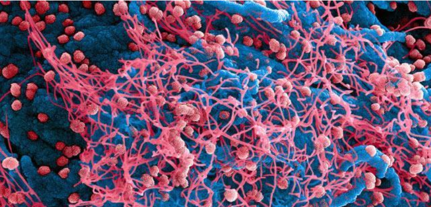 科学家:哈佛科学家:4种方式可能终结新冠病毒,大流行结束或快于预期!