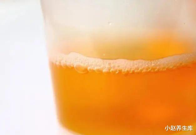 尿毒症:一家三口查出尿毒症,需终身透析,提醒:2件事惹的祸,不知克制