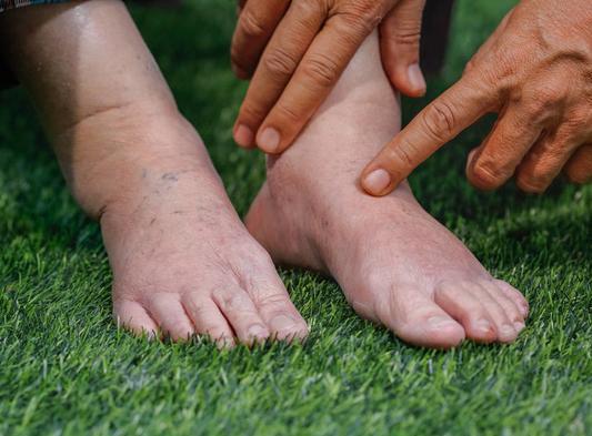 排毒▲34岁男子，尿酸高达810，肾衰入院，医生无奈：怎能拿它当水喝