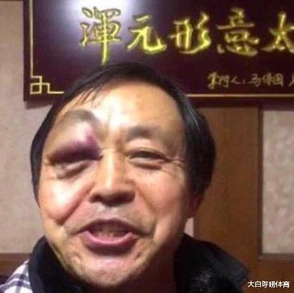 『马保国』马保国老师输后感言：如果当时我不收拳，他的鼻子就骨折了