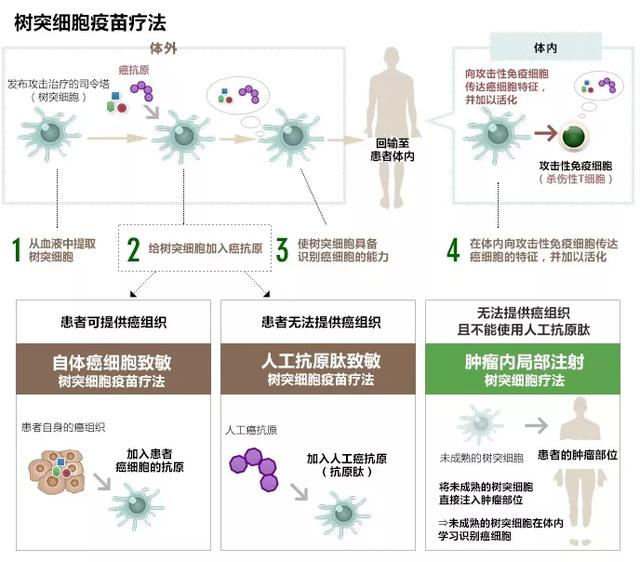 [癌细胞]癌症将被疫苗终结？树突细胞疫苗再升级，肿瘤无病生存率达73%！