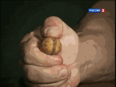 肝癌|肌肉猛男的尴尬：永久性“变弯”，掰都掰不直...