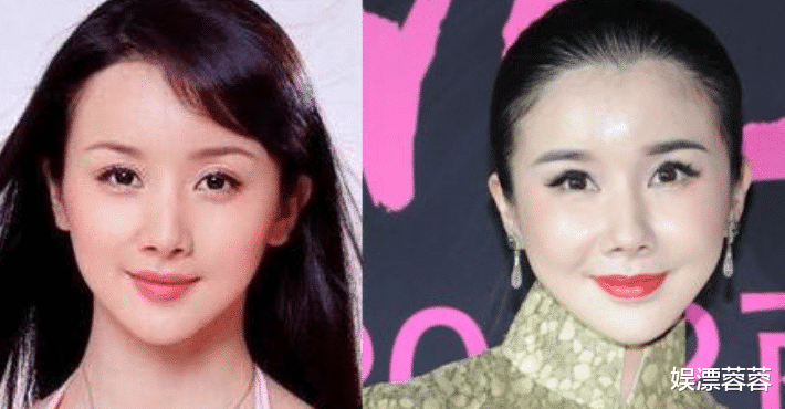 整容|?整容整毁了的5位明星红人， 正常人已无法欣赏你们的盛世美颜了！