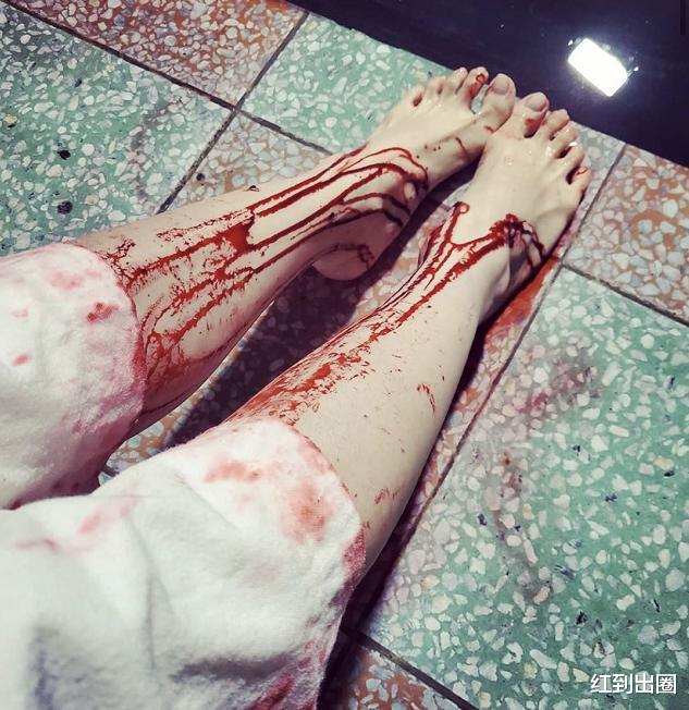 蔡依林|蔡依林晒双腿流血照，脚下地板都被染红，经纪人亲自回应曝近况