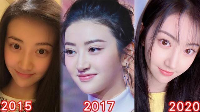 景甜|景甜首次承认整容，坦言非常后悔，每天以泪洗面，抑郁了很长时间