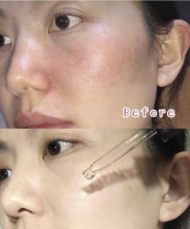 李佳琦▲李佳琦晒出“续命”精华液，价格一曝光后，网友：我丢掉了兰蔻