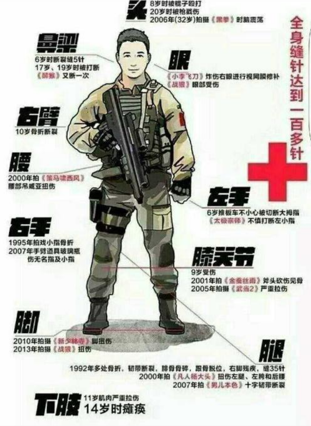 谢楠|吴京曝谢楠桡骨钢钉照!形状像耙子看着就疼,两人乐观互动显甜蜜