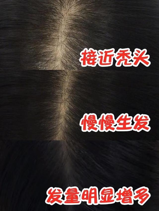 洗发水：头发打湿后别急着抹洗发水，这样洗头很伤发，难怪这么多年都掉发