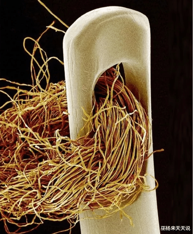 显微镜|22张显微镜下看到的奇妙的照片，看完还敢这样刮胡子吗？