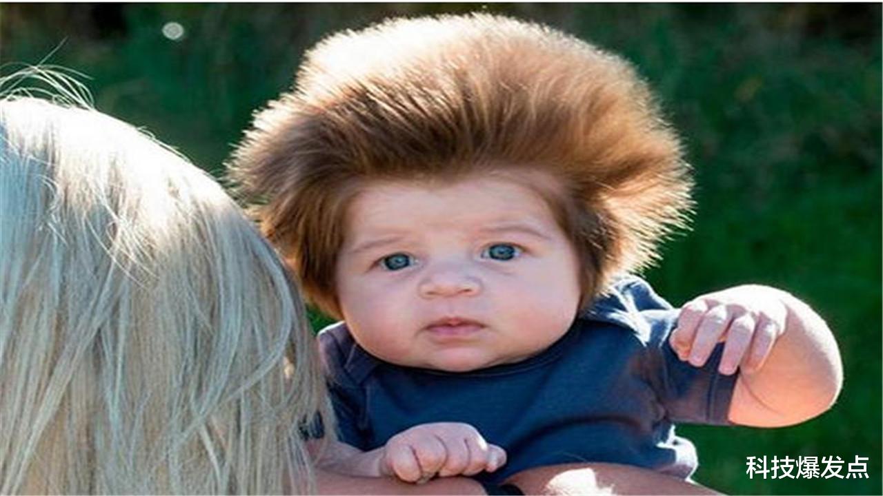 超能力|被雷击中后获得“超能力”，身体发生变化，科学医学尚无法解释！