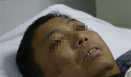 肝脏|身体3个部位发黑，可能是肝病来临，一个不占，恭喜你肝很健康