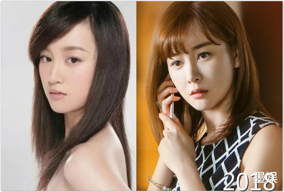 张檬|明星整容早已是公开的秘密,难就难在她们不懂“见好就收”