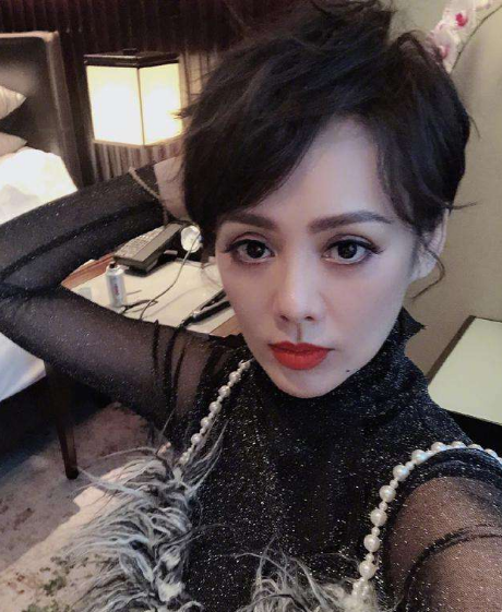 糖尿病|玻尿酸“失业了”！抗衰界“小米”问世，紧致提拉养成“女神脸”
