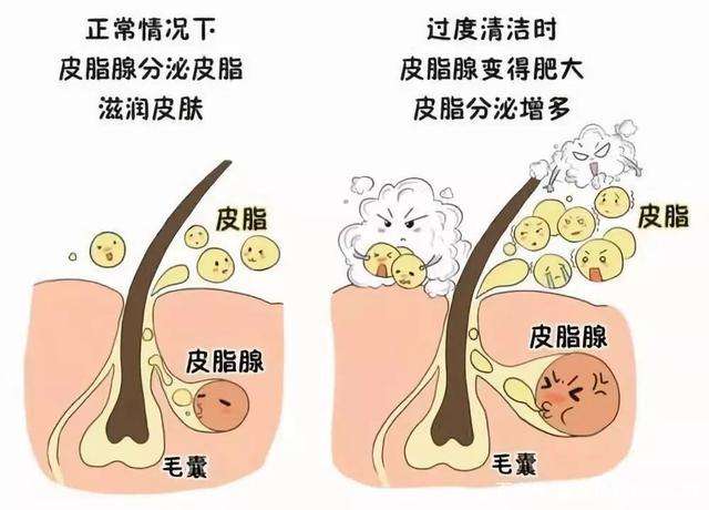 面膜|为啥有些人不护理肌肤状态却很好?原来是避开了这些“坑”