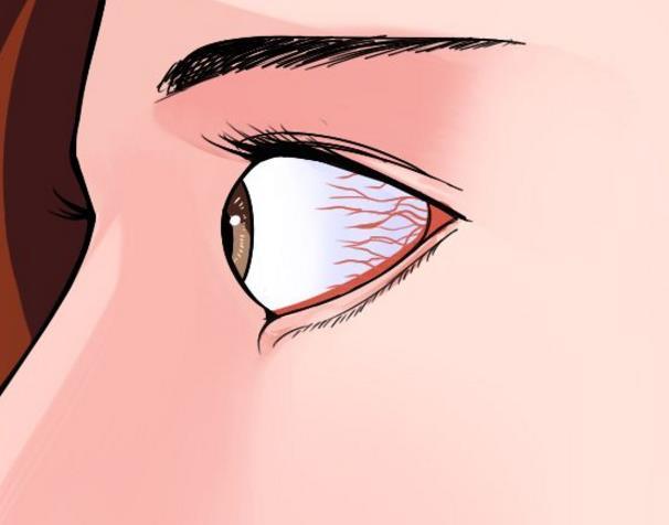 ##体内有疾，眼睛先知，眼睛出现这些情况，当心大病来袭！