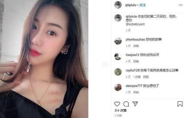 科比·布莱恩特▲孙悦娇气疑似遭到家暴，身上写满了悲伤，却不忘缅怀科比