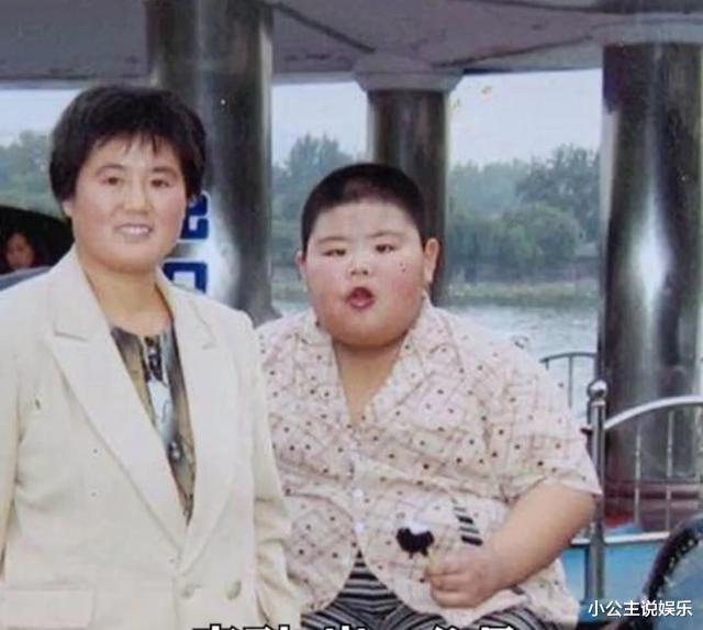 医生|励志！他是中国第一胖，为减肥切胃，并开始锻炼为爱减重400斤