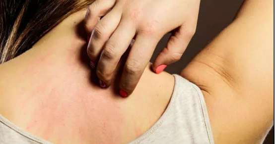 这些身体异常非重视不可，它们是甲醛中毒的表现，务必提高警惕