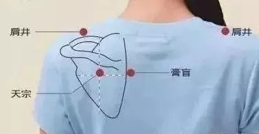 「经络」颈肩问题，久治不断根，是这里“寒气”没有化解