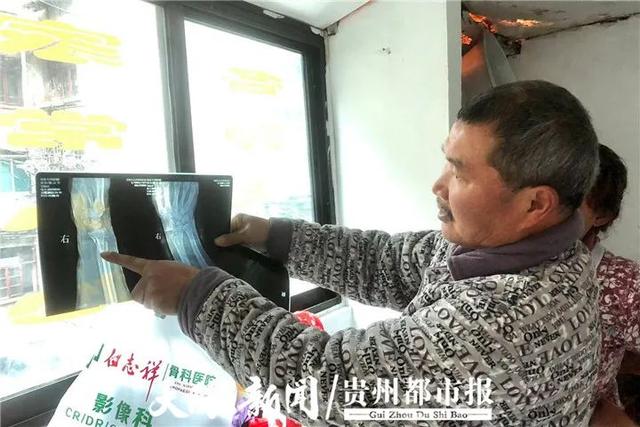 贵州都市报 贵阳一小区门口有条20米“破烂路”！多位居民摔伤，呼吁赶紧修好