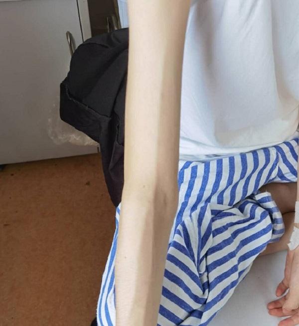 话晴空|杭州13岁初中生，短时间内体重掉到60斤，医生：催吐手