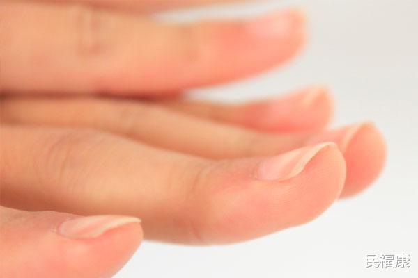 肝脏|肝有没有受损,手部会有提示,哪些信号出现,暗示肝病上身了?