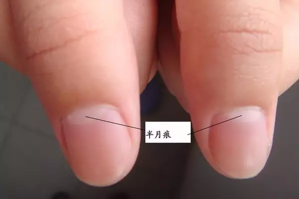 |为什么有的人指甲上有月牙，有的人却没有？这才是科学的解释