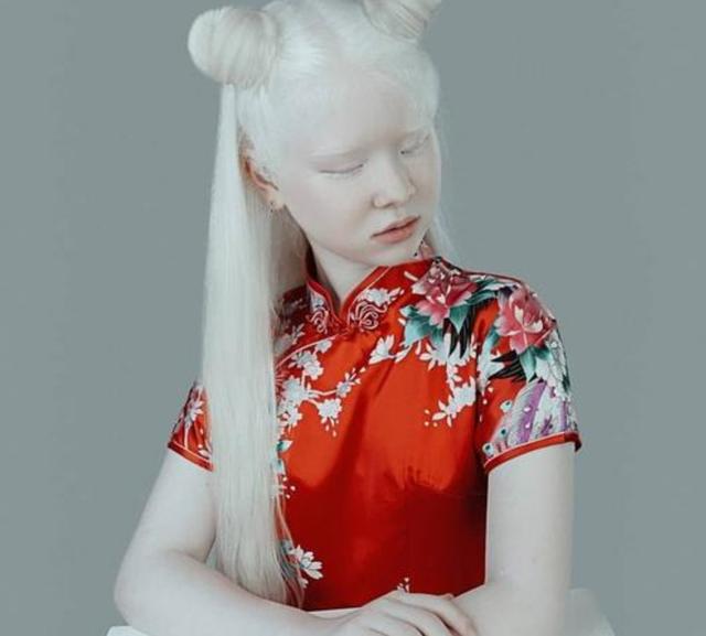 墨语笙歌|姐妹一出生就“没有颜色”，生活中遭备受歧视，如今现状如何