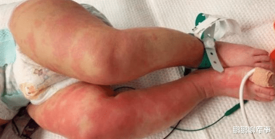 [朴槿惠]病毒变异？特朗普闯下大祸！美民众绝望：救救我孩子吧！